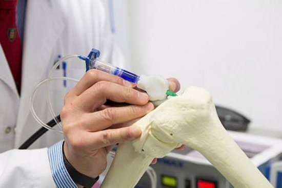 手持3D打印笔问世 可在手术中打印人体骨骼