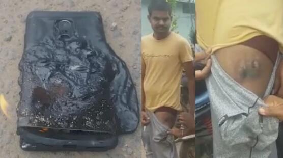 红米Note 4手机裤兜中爆炸 印度用户大腿受伤