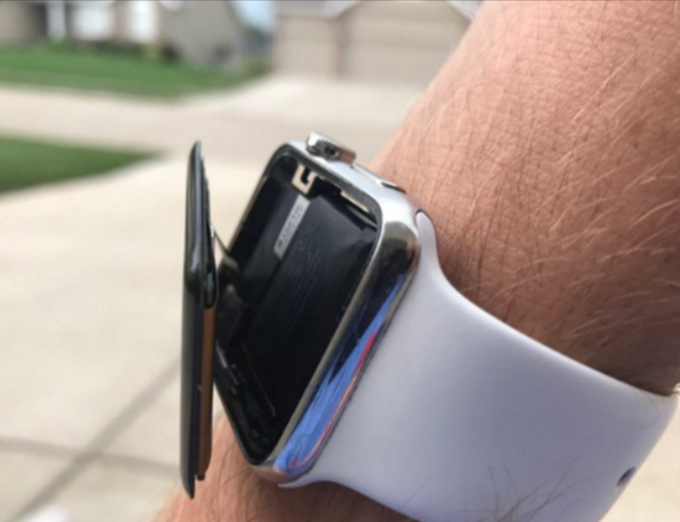  Apple Watch刚迎心电图完全体，却遭新麻烦，电池鼓包被集体诉讼